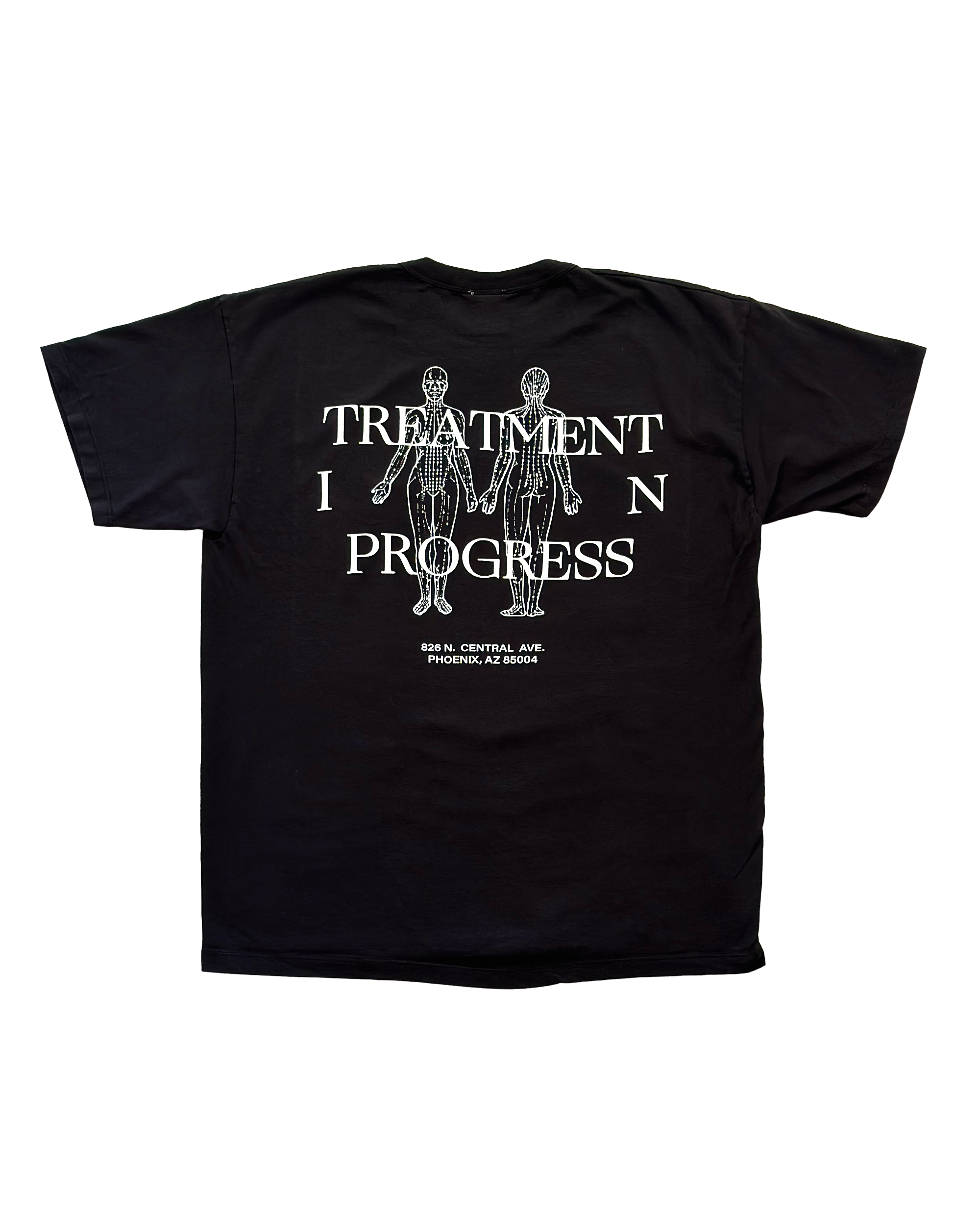 Treatment In Progress Tee — Black