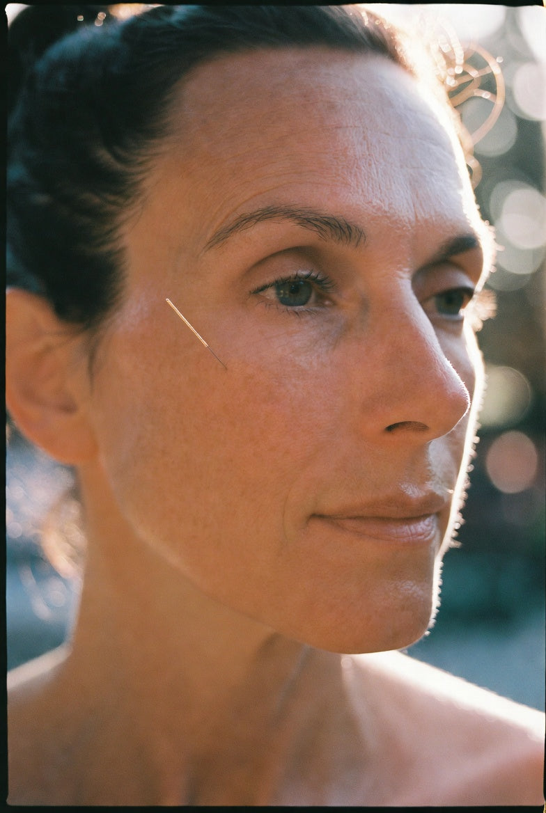 Facial Acupuncture vs. Botox: What's Actually Different