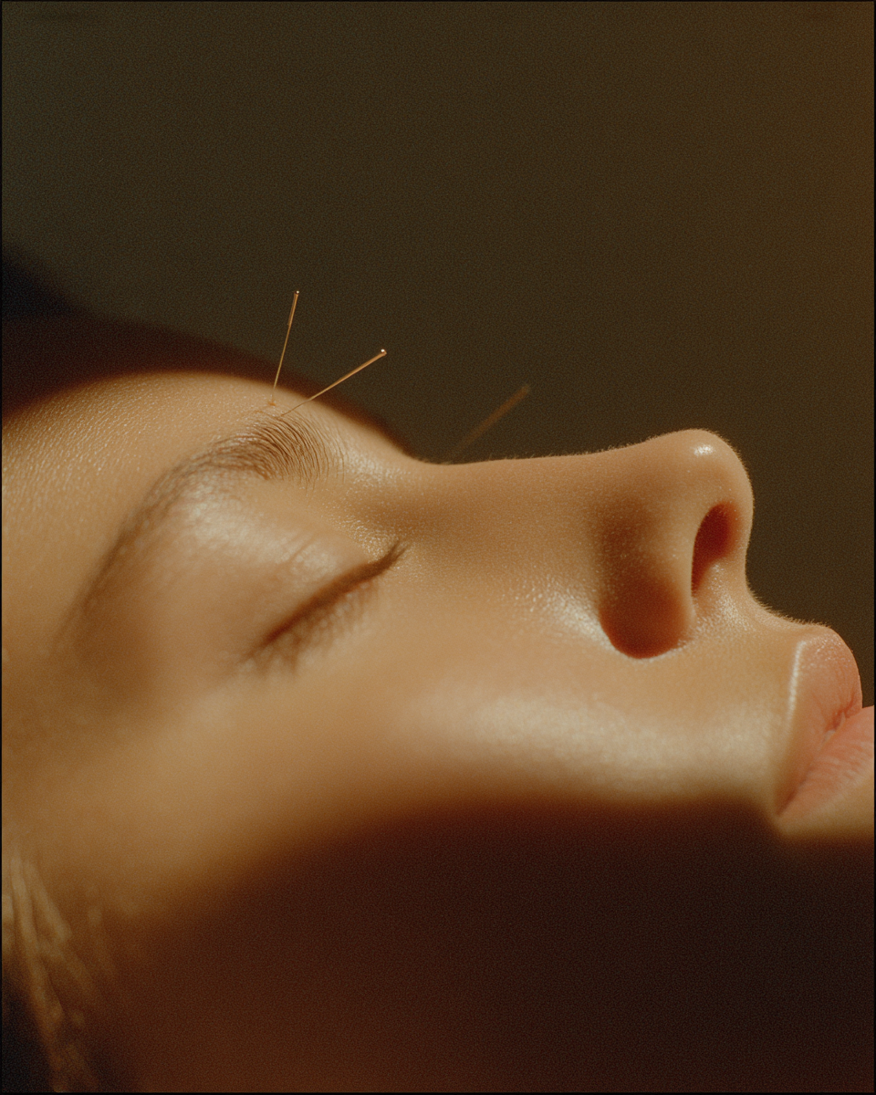 What Is Facial Acupuncture? What to Expect at Your First Session
